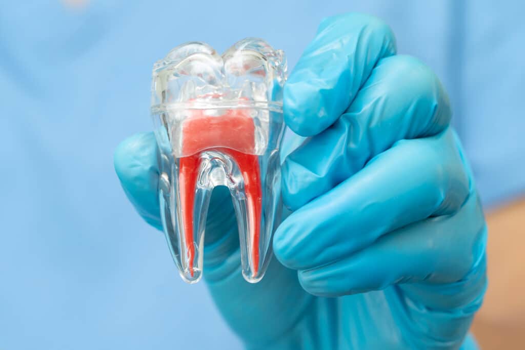 Dentista explica una reendodoncia con un modelo de diente