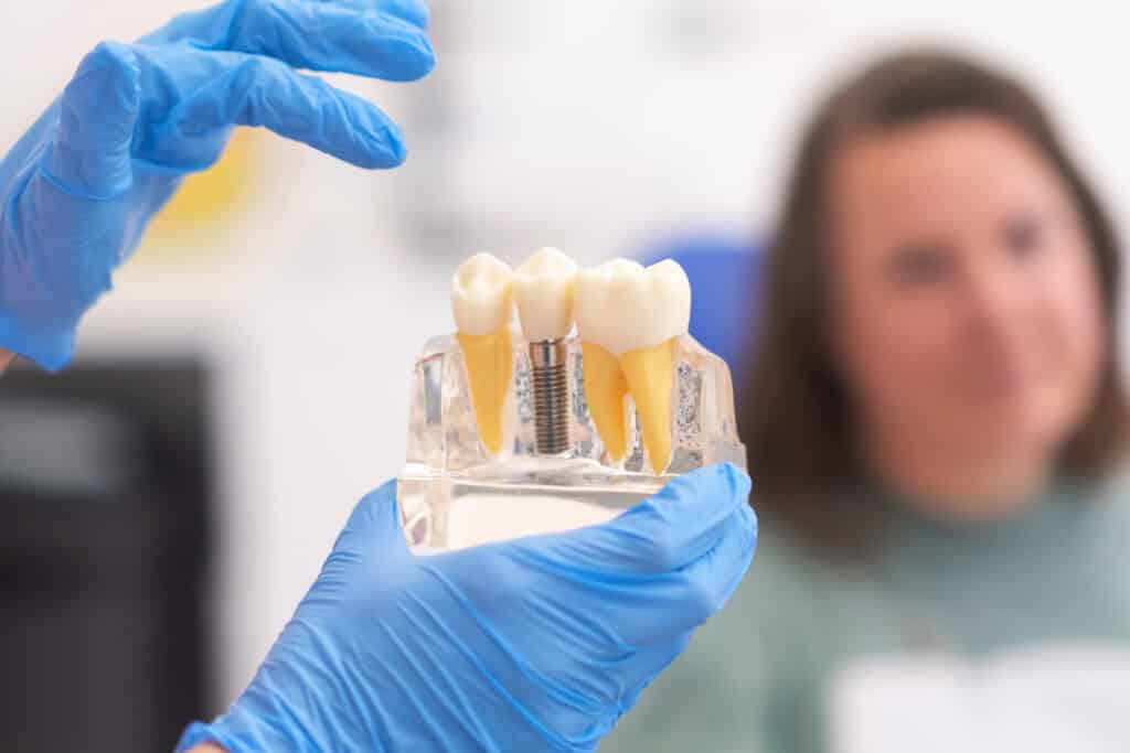 Dentista enseñando un modelo de implante post-extracción