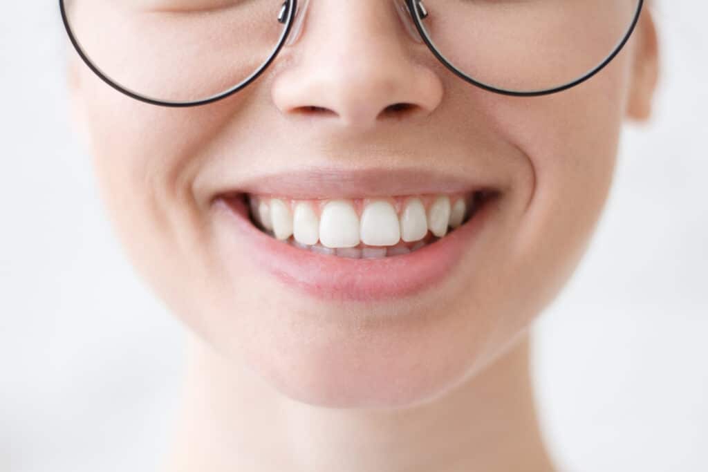 Mujer enseñando su sonrisa tras un blanqueamiento dental