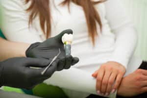 Dentista con modelo de Implante de Carga Inmediata