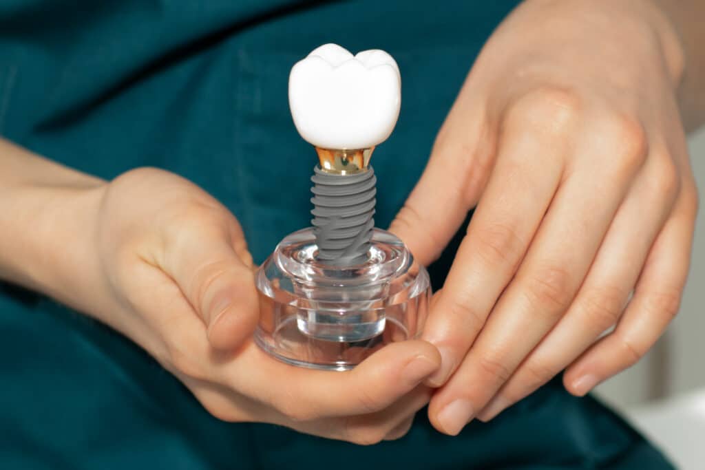 Dentista enseñando modelos de implantes dentales