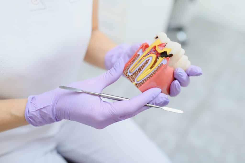Dentista explicando una endodoncia dental