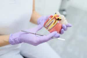 Dentista explicando una endodoncia dental