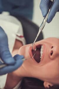 Periodoncia dental en panciente