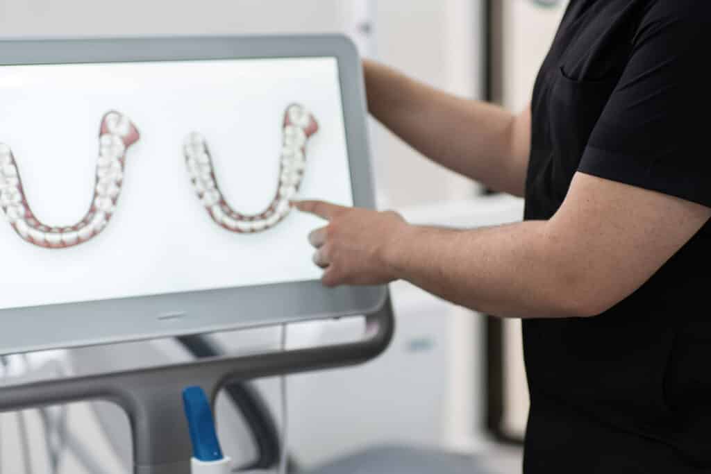 Dentista enseñando un tratamiento antirronquidos